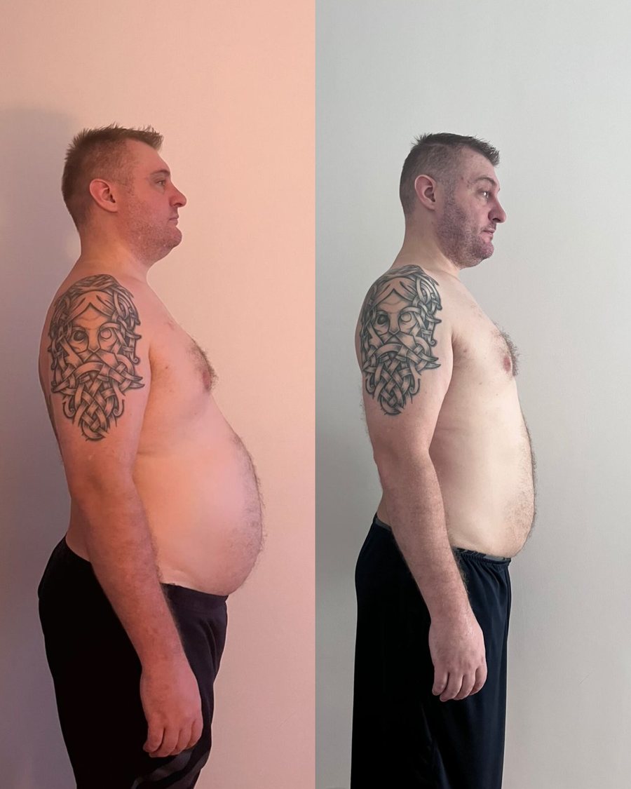 CJ, side view before and after