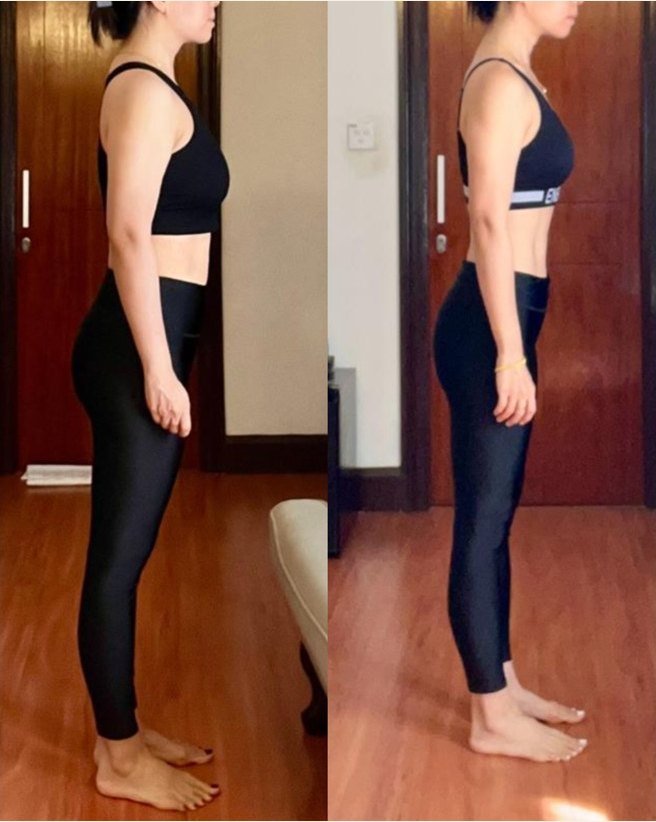 Jennifer, side view before and after